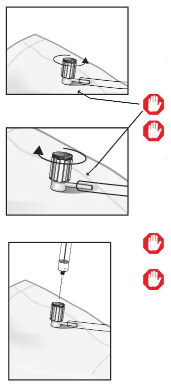 SKC-232-01-Single-Polypropylene-Fitted-Bags-2