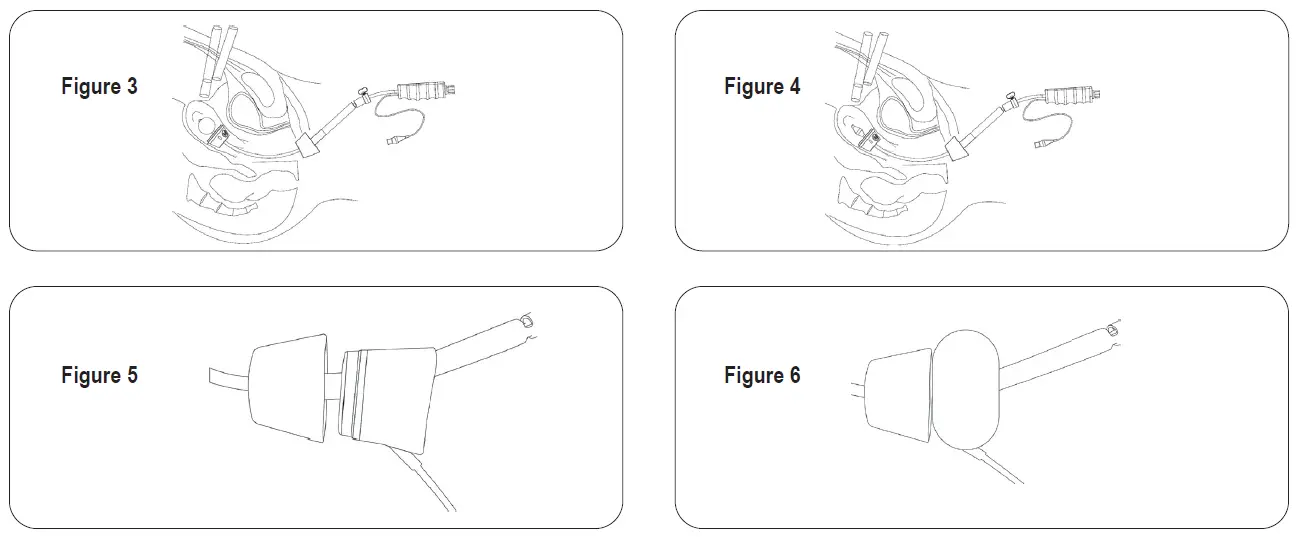 THE O R COMPANY UE-OBPRO-32 Uterine ElevatOR Pro with OccludOR Balloon 2