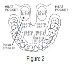 ADC 413BK Adtemp 413 Digital Stick Thermometer fig 2