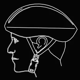 FIG 1 Correct Fitting