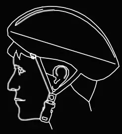 FIG 2 Incorrect Fitting