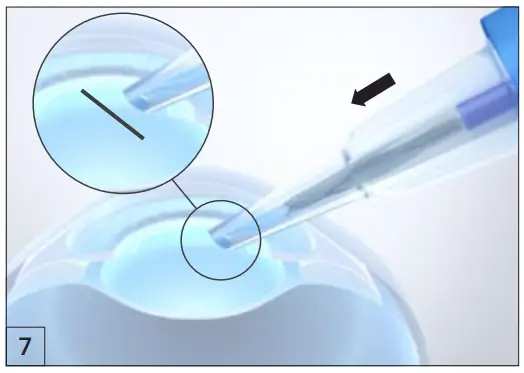 ZEISS BLUEMIXS 180 Injector - facing down