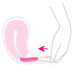 INTIMINA-ziggy-Cup-2-Reusable-Menstrual-Disc-fig- (5)