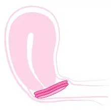 INTIMINA-ziggy-Cup-2-Reusable-Menstrual-Disc-fig- (6)