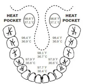 FORA Digital Thermometer MT86-temperature