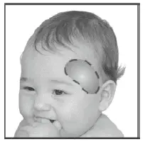 Forehead measurement