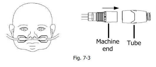 BMC NC11L Nasal Cannula - nostril g4