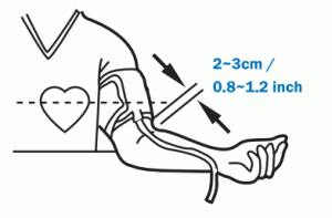 FORA D40g Blood Pressure and Glucose Monitoring System - Blood Pressure