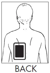 ZOLL-Stat-Padz-Multi-Function-CPR-Electrode-3