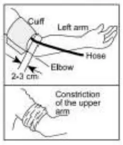 Cuff tube connection
