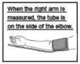 Cuff tube connection