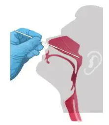 JOYSBIO SARS CoV 2 Antigen rapid test kit- Nasopharyngeal