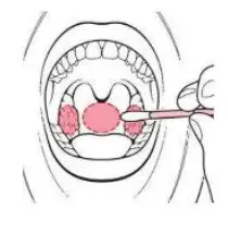 JOYSBIO SARS CoV 2 Antigen rapid test kit- Oropharyngeal