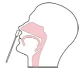 JOYSBIO SARS CoV 2 Antigen rapid test kit- step 2