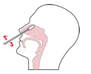 JOYSBIO SARS CoV 2 Antigen rapid test kit
