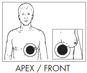 ZOLL-Pro-Padz-Cardiology-Specialty-Gel-Electrode- (2)