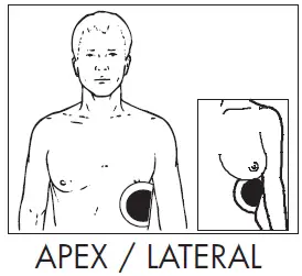 ZOLL-Pro-Padz-Cardiology-Specialty-Gel-Electrode- (4)