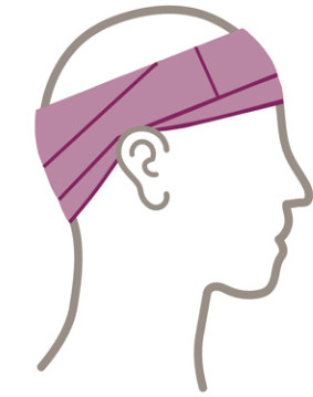 Cochlear Osia 2 Hearing System- Bandaging 3