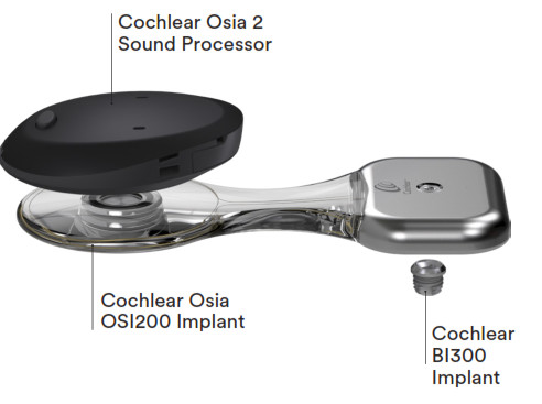 Cochlear Osia 2 Hearing System