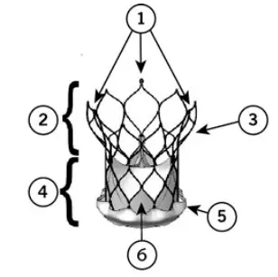 Abbott Navitor Titan Transcatheter Aortic Valve Implantation System - Figure 1