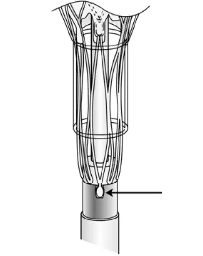 Abbott Navitor Titan Transcatheter Aortic Valve Implantation System - Figure 7
