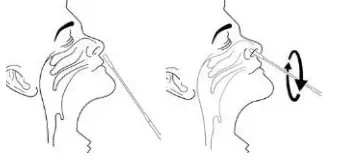 NIDS COVID-19 Antigen Rapid Test Kit - Collectspecimen