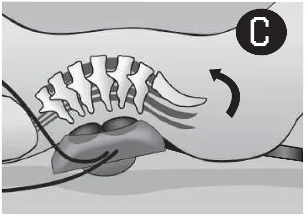 PENTAVAC 2500 Posture Pump 17