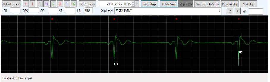 NorthEast-Monitoring-LX-Event-DR400-Patch-Style-Holter-Recorder-FIG-12