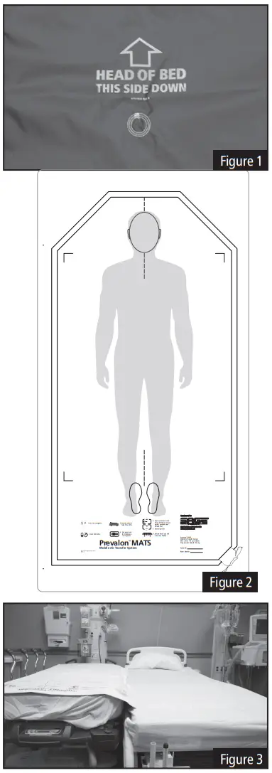 Sage 3242 R Prevalon MATS Mobile Air Transfer System - fig