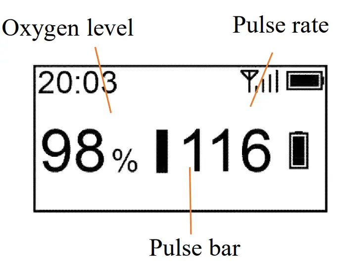 viatom PO5 BabyO2 Infant Pediatric Pulse Oximeter - fig 4