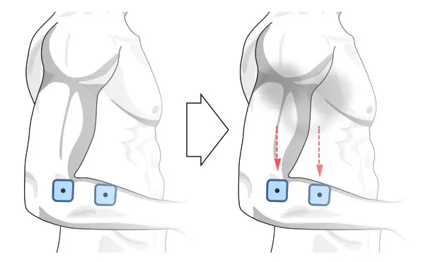 chattanooga Wireless Professional 4 Channel STD- MODULE SETUP