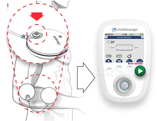 chattanooga Wireless Professional 4 Channel STD- TURN ON MODULE