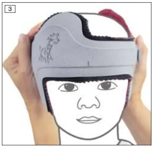 ottobock 24H1 MyCRO Band-fig5