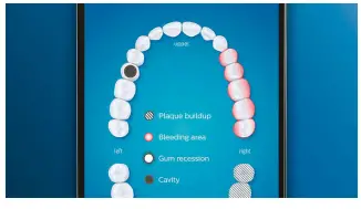 PHILIPS -HX9985-11-DiamondClean-Smart-Sonic-Electric-Toothbrush-with-App-fig5