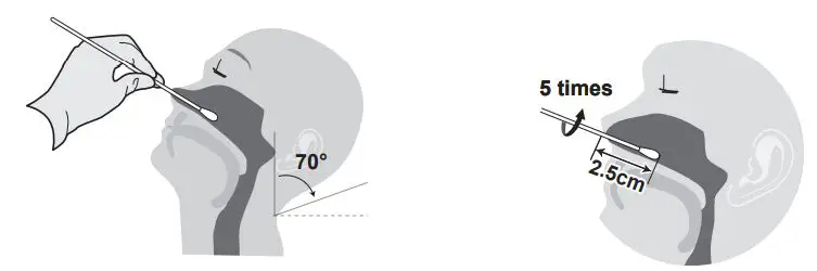 FORA COVID-19 Antigen Rapid Test Instruction Manual - Mid-turbinate or Anterior nasal Sample