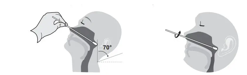 FORA COVID-19 Antigen Rapid Test Instruction Manual - Nasopharyngeal Swab Sample