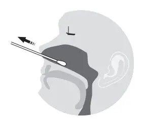 FORA COVID-19 Antigen Rapid Test Instruction Manual - Tilt the head back about 70 degrees