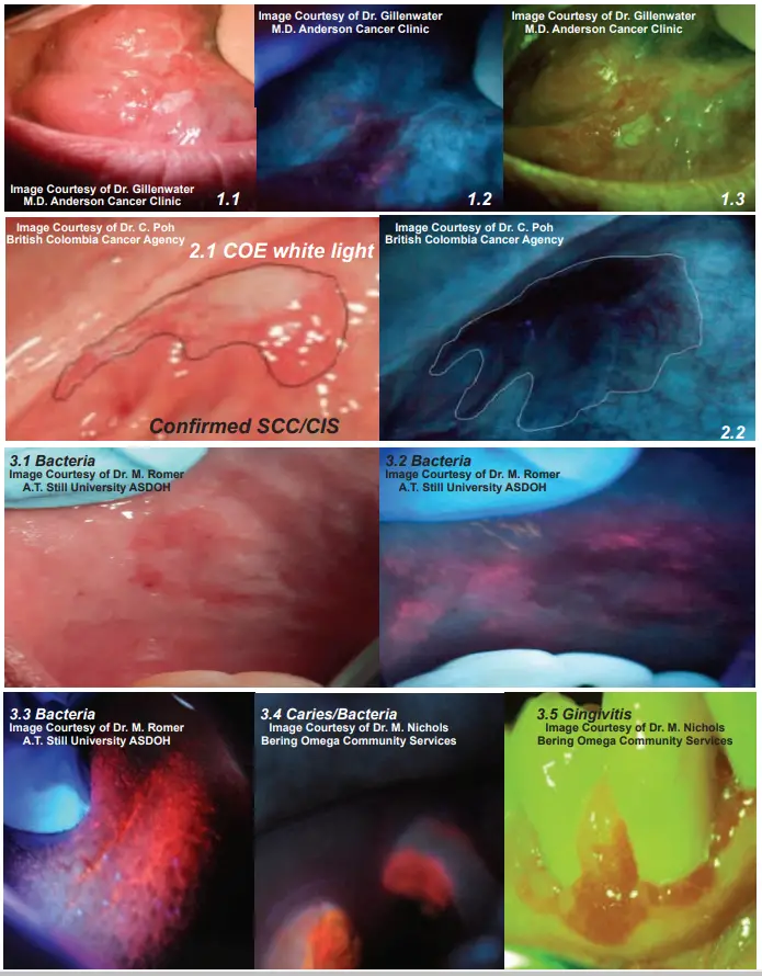 Identifi RT3-00371 Oral Mucosal Visual Enhancement System - icon2