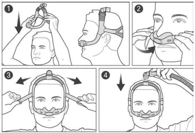 ResMed-A7034-AirFit-N30i-Nasal-Mask-System-FIG-2