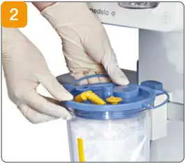 medela CaesAid Cup B02