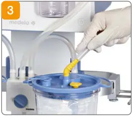 medela CaesAid Cup C03