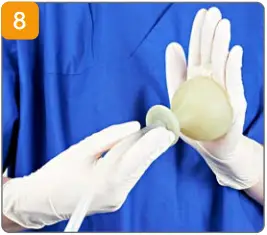 medela CaesAid Cup C08