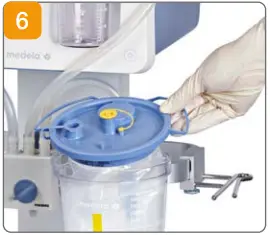 medela CaesAid Cup E06