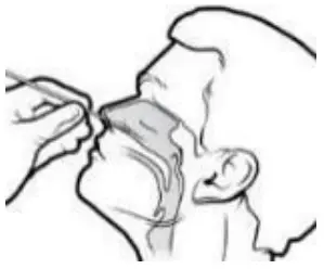 Specimen Collection And Preparation