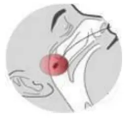 Specimen Collection And Preparation