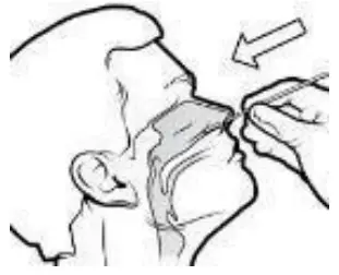 Specimen Collection And Preparation