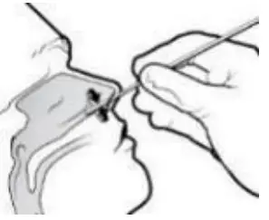 Specimen Collection And Preparation