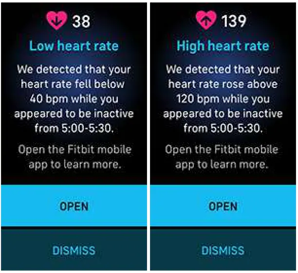 Fitbit Sense FB512 Advanced Smartwatch with Tools for Heart Health - Receive heart-rate notifications