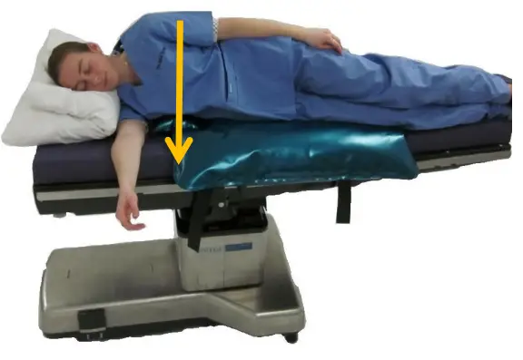 Hillrom A-90002 -LPS -Arm -Support- 7