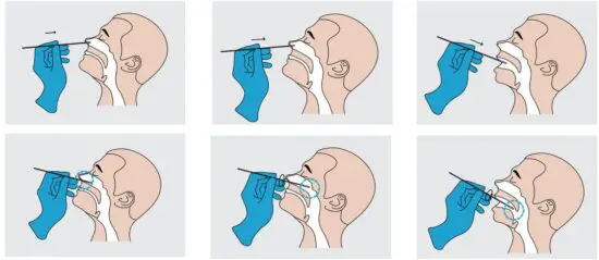 LFIA SARS-CoV-2 Antigen Test Kit-fig1